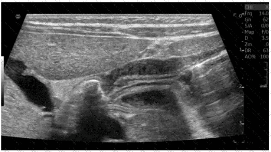 AB-Abdomen Question 23