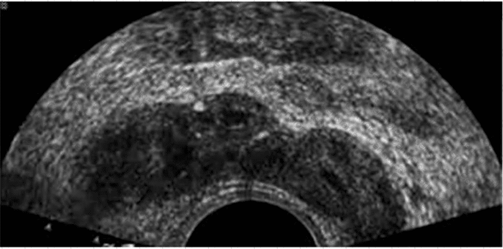AB-Abdomen Question 17