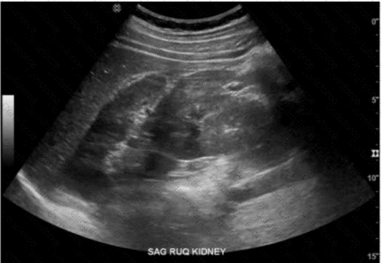 AB-Abdomen Question 45