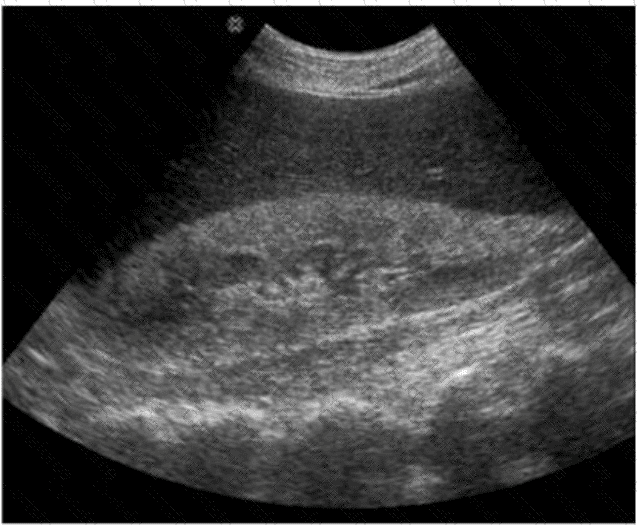 AB-Abdomen Question 24