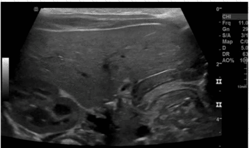 AB-Abdomen Question 12