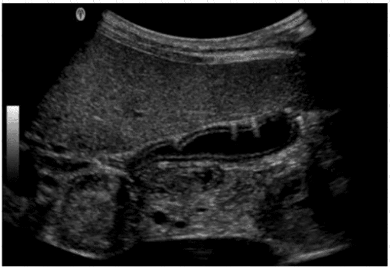 AB-Abdomen Question 14
