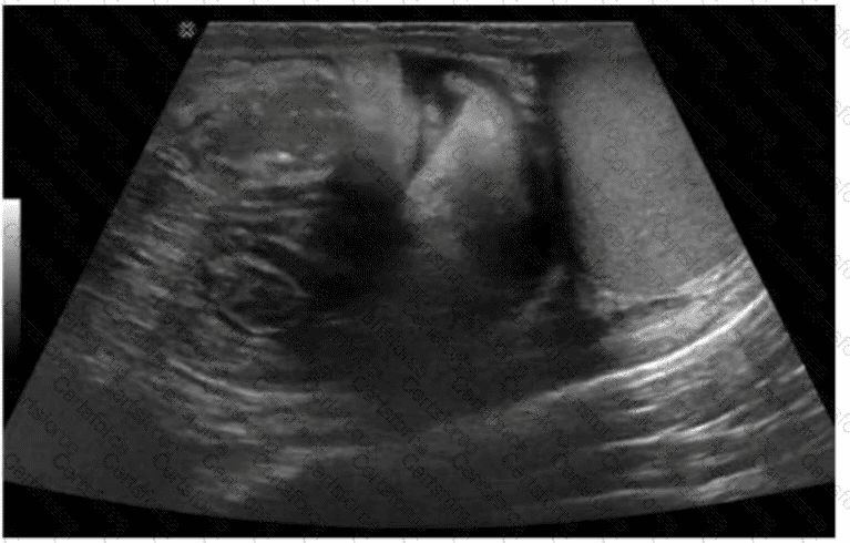 AB-Abdomen Question 31