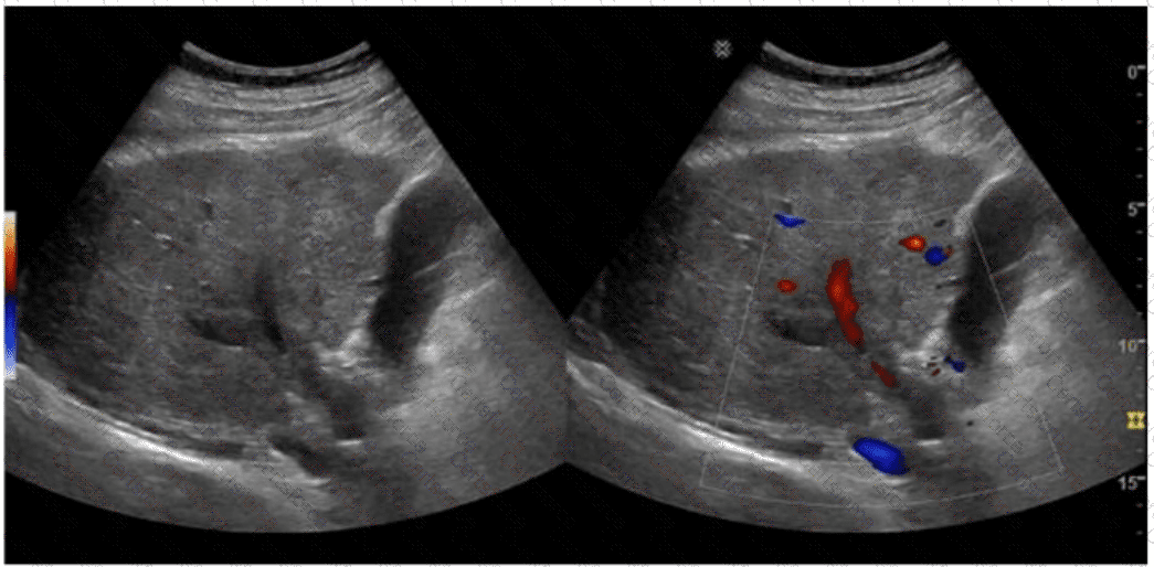 AB-Abdomen Question 47